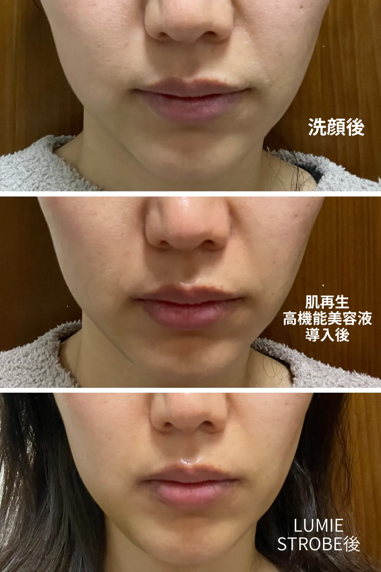 スキンケアで-10歳肌